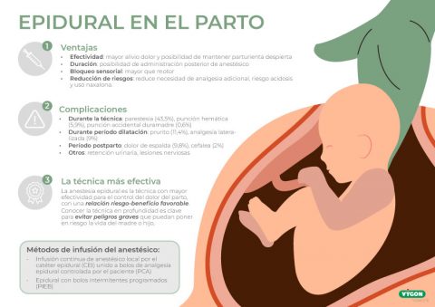 Anestesia epidural en el parto Campus Vygon España