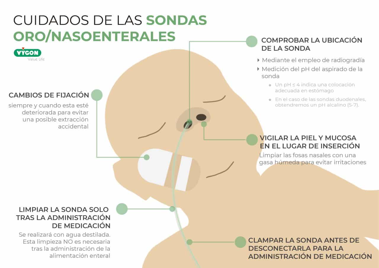 Cuidados De Las Sondas Oro Nasoenterales