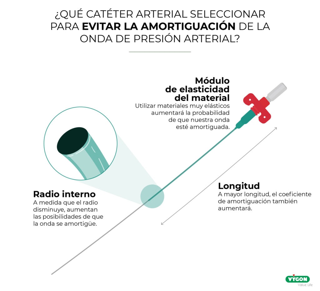 9 claves para una canalización arterial exitosa Campus Vygon