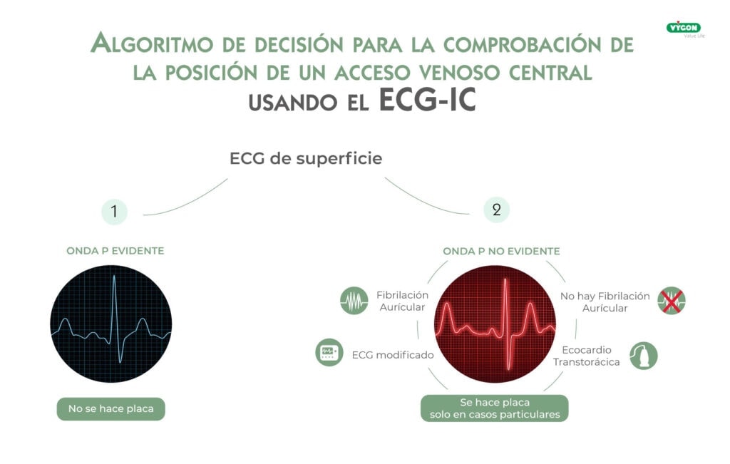 Algoritmo de decisión para la comprobación de la posición de un acceso venoso central