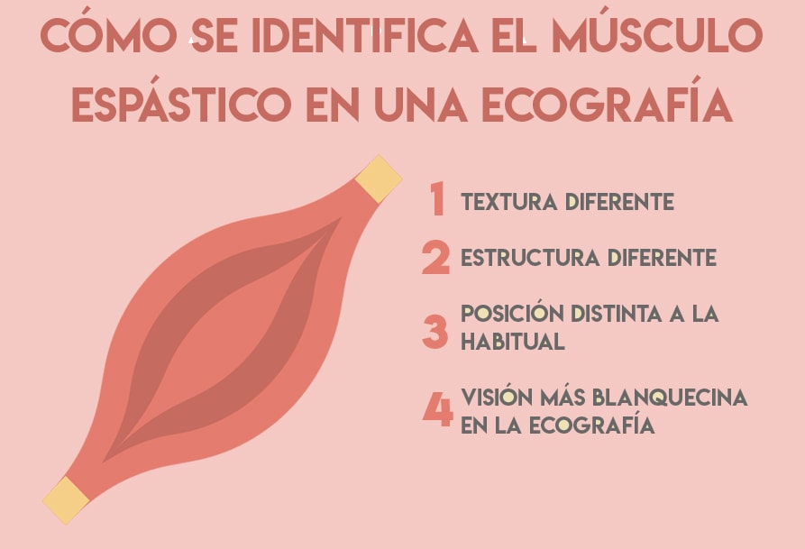 espasticidad