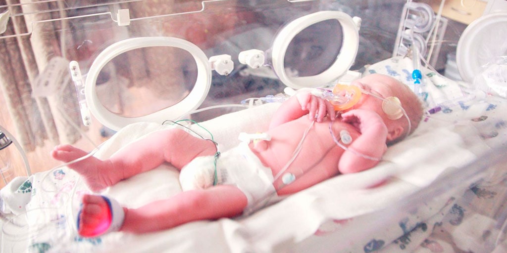 Combatir el SDR neonatal: ¿Método INSURE o LISA?