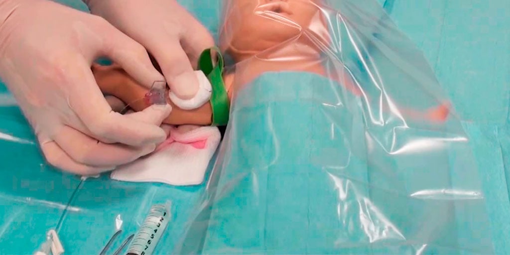 8 consejos para la inserción del PICC en neonatos