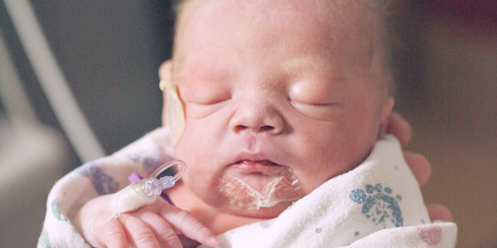 Guía para el cuidado y mantenimiento de PICC neonatal
