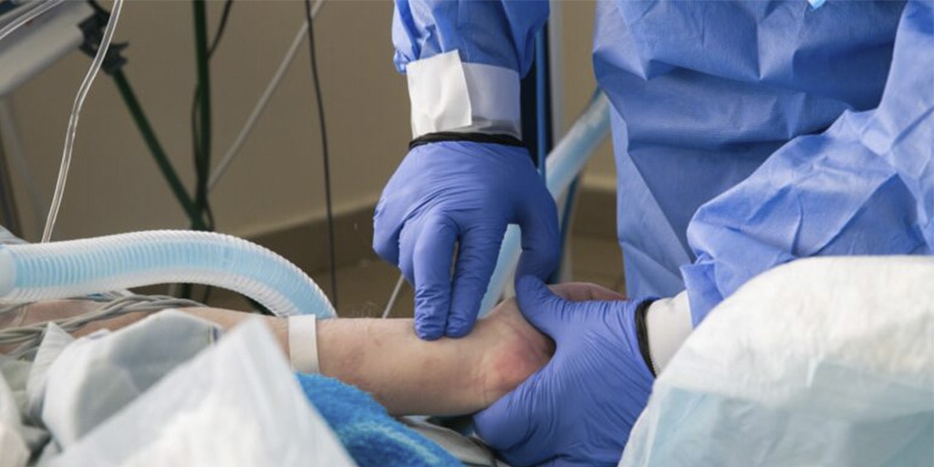 Maximizar el rendimiento de un acceso vascular en pacientes COVID: colocación y mantenimiento