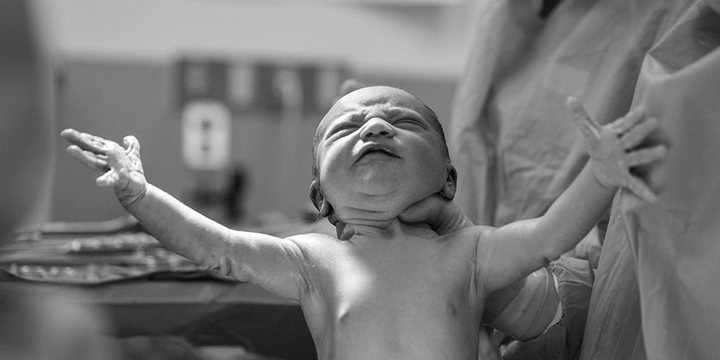 Whitepaper: La revolución de la neonatología