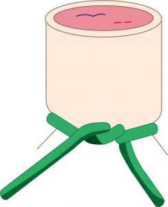 Cinta umbilical