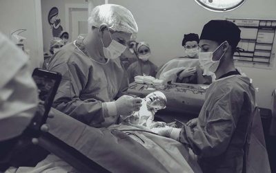 La tendencia hacia la walking epidural en el parto y sus ventajas
