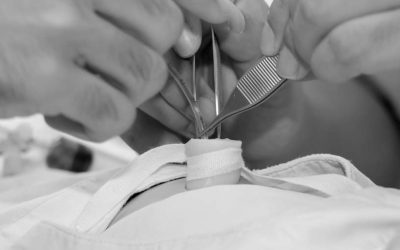 Complicaciones en catéteres umbilicales: ¿Cuándo retirar el catéter?