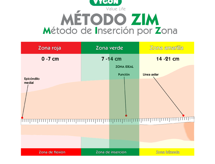 Método ZIM