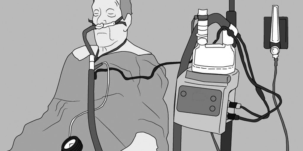 Whitepaper: CPAP vs Alto Flujo: ¿por qué elegir si las puedes combinar con mejores resultados?