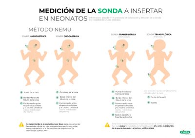 Medición de la sonda a insertar en neonatos