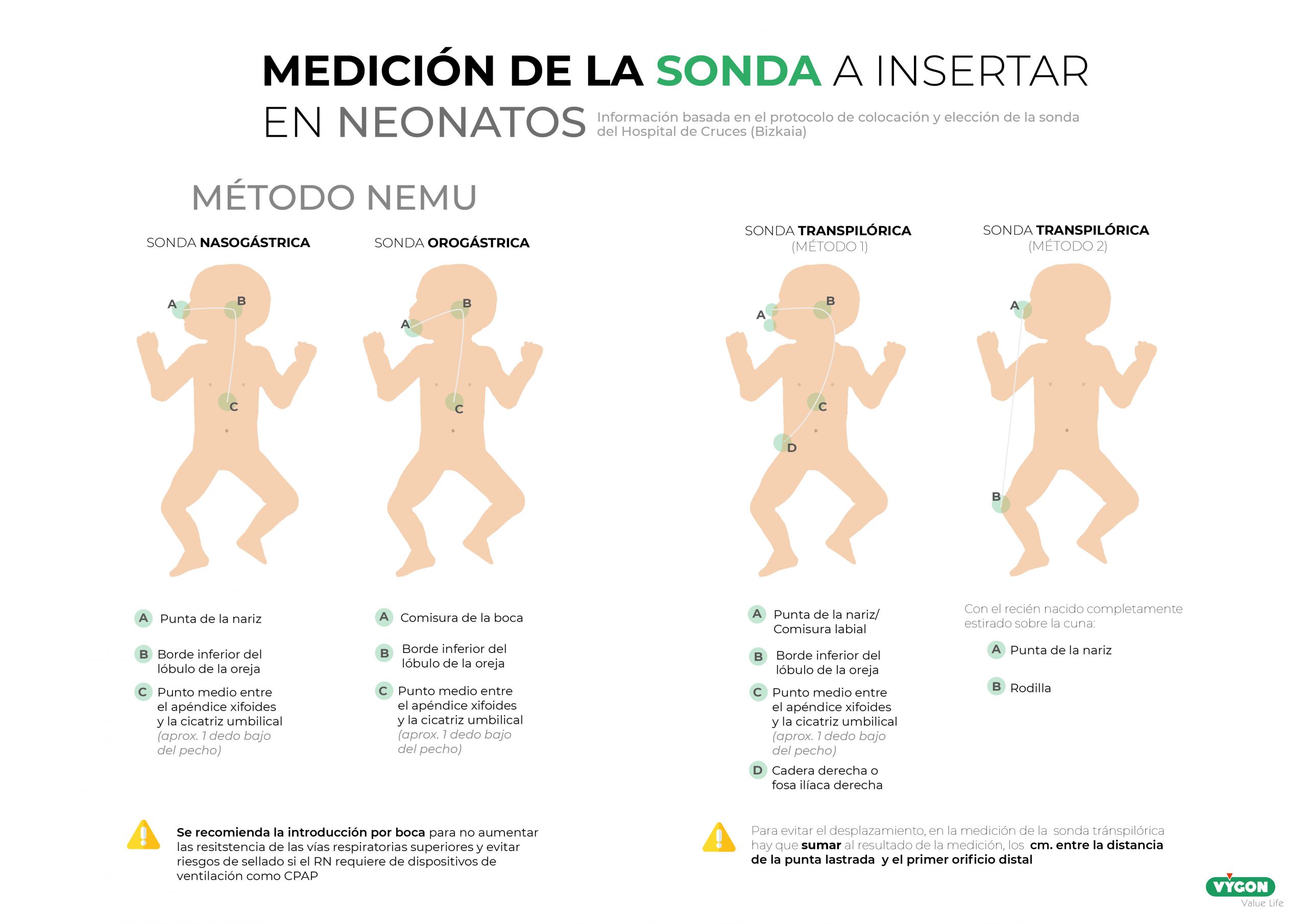 Medición de la sonda