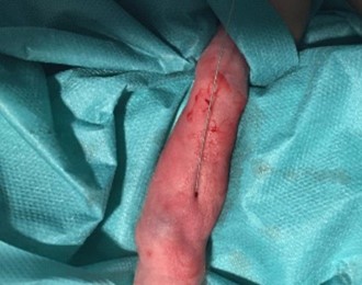 Imagen2
