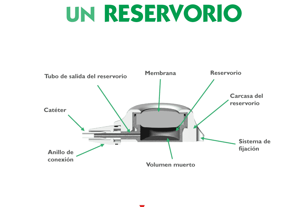 Componentes de un reservorio