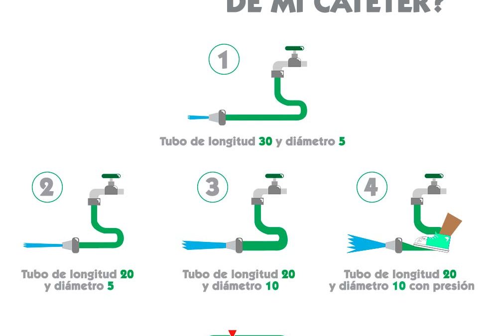 ¿De qué depende el flujo de mi catéter?