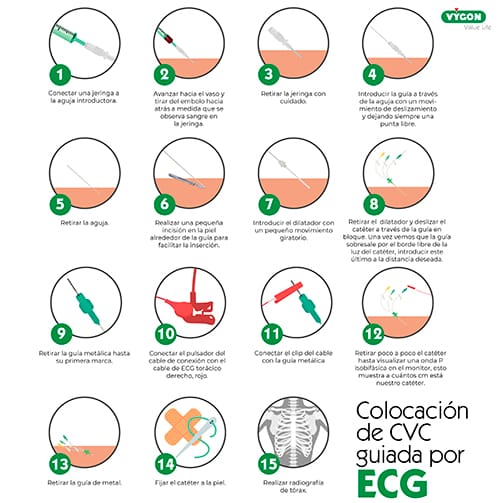 precisión vs exactitud