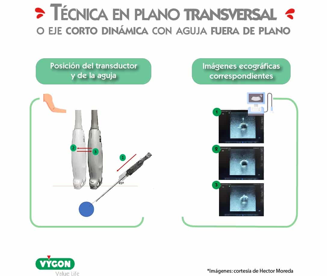 precisión vs exactitud