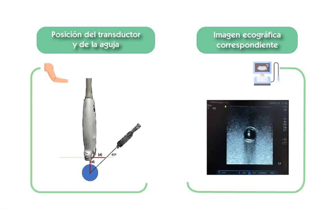Técnica ecográfica estática en plano transversal