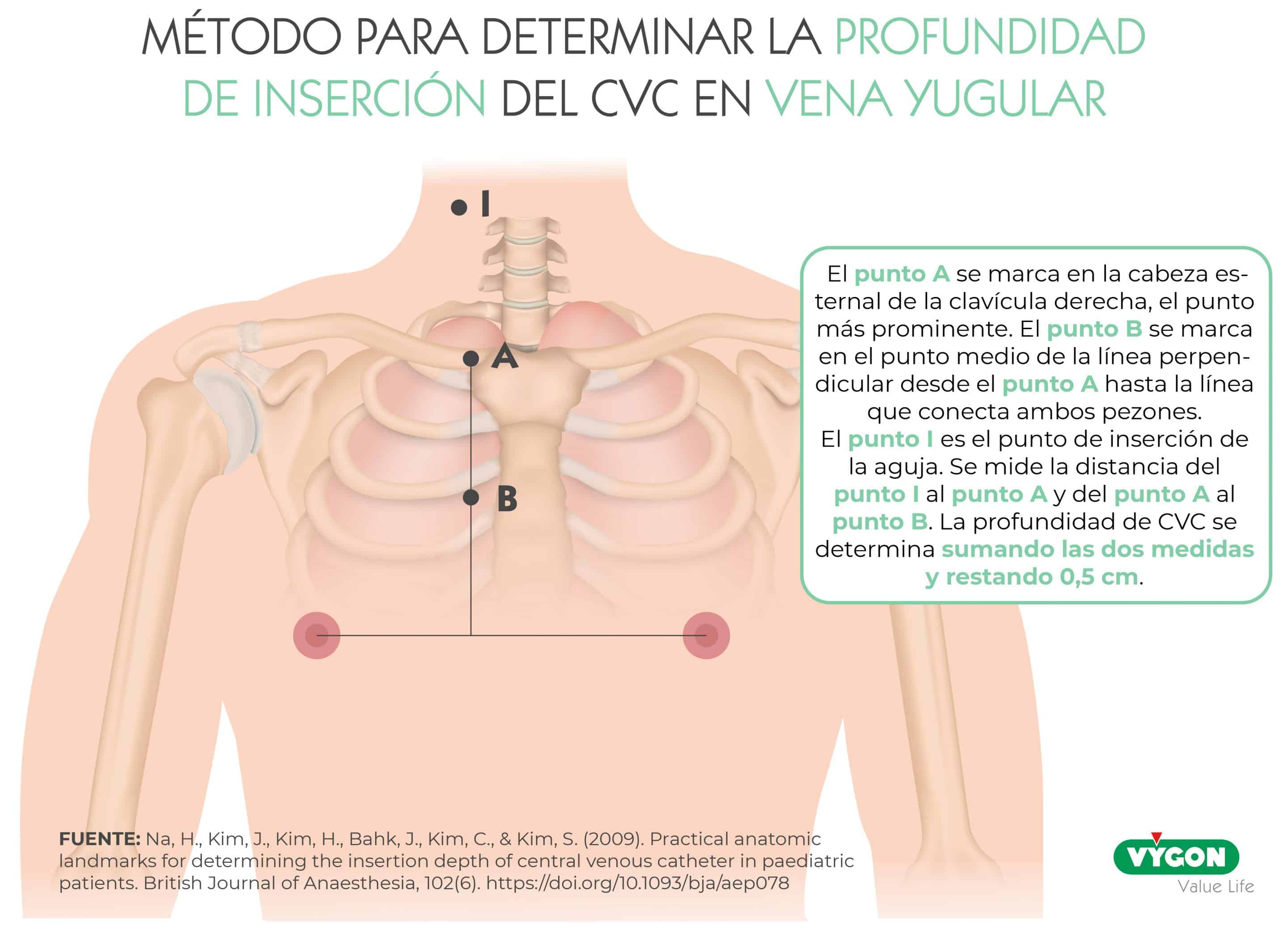 precisión vs exactitud