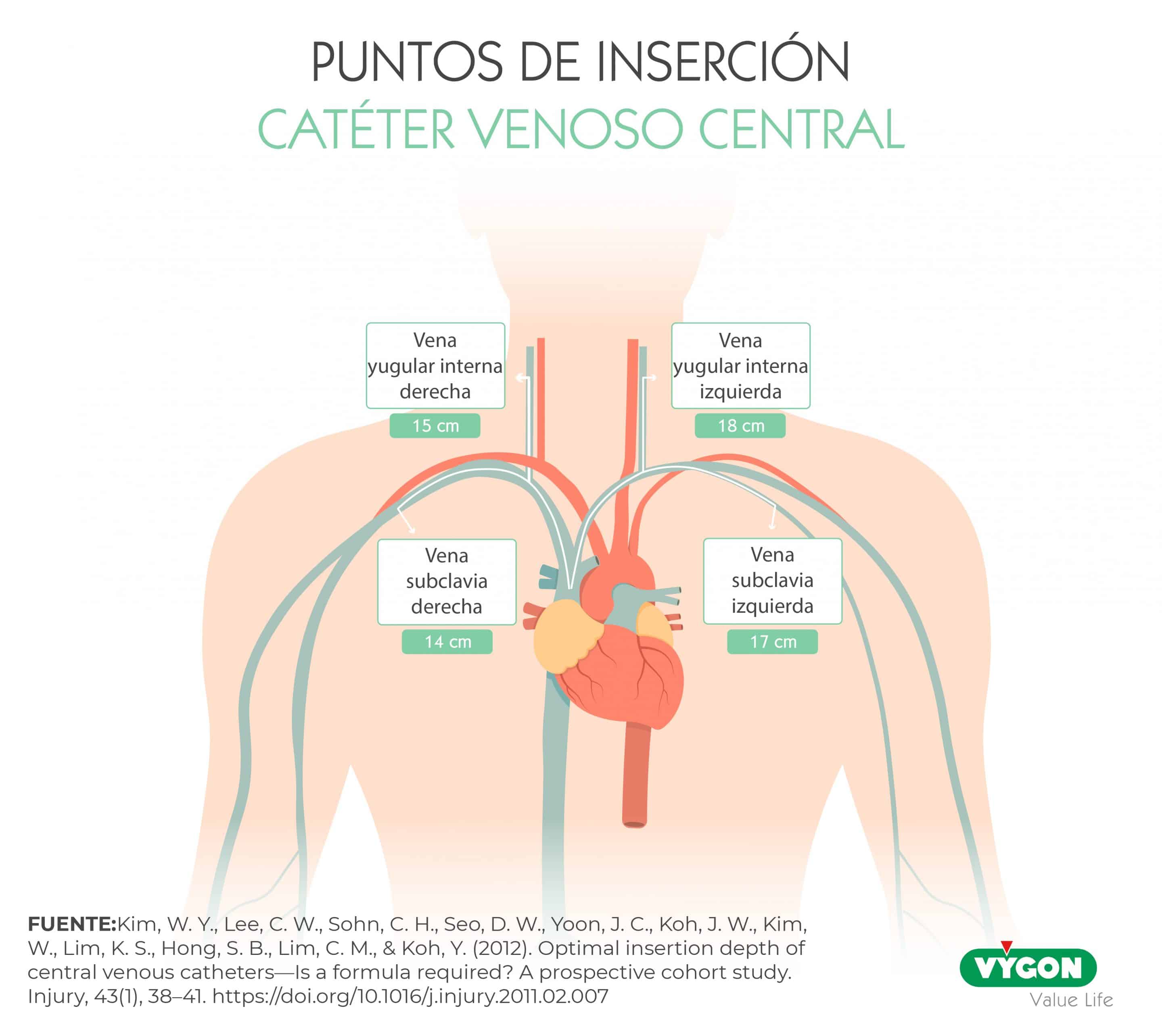 precisión vs exactitud