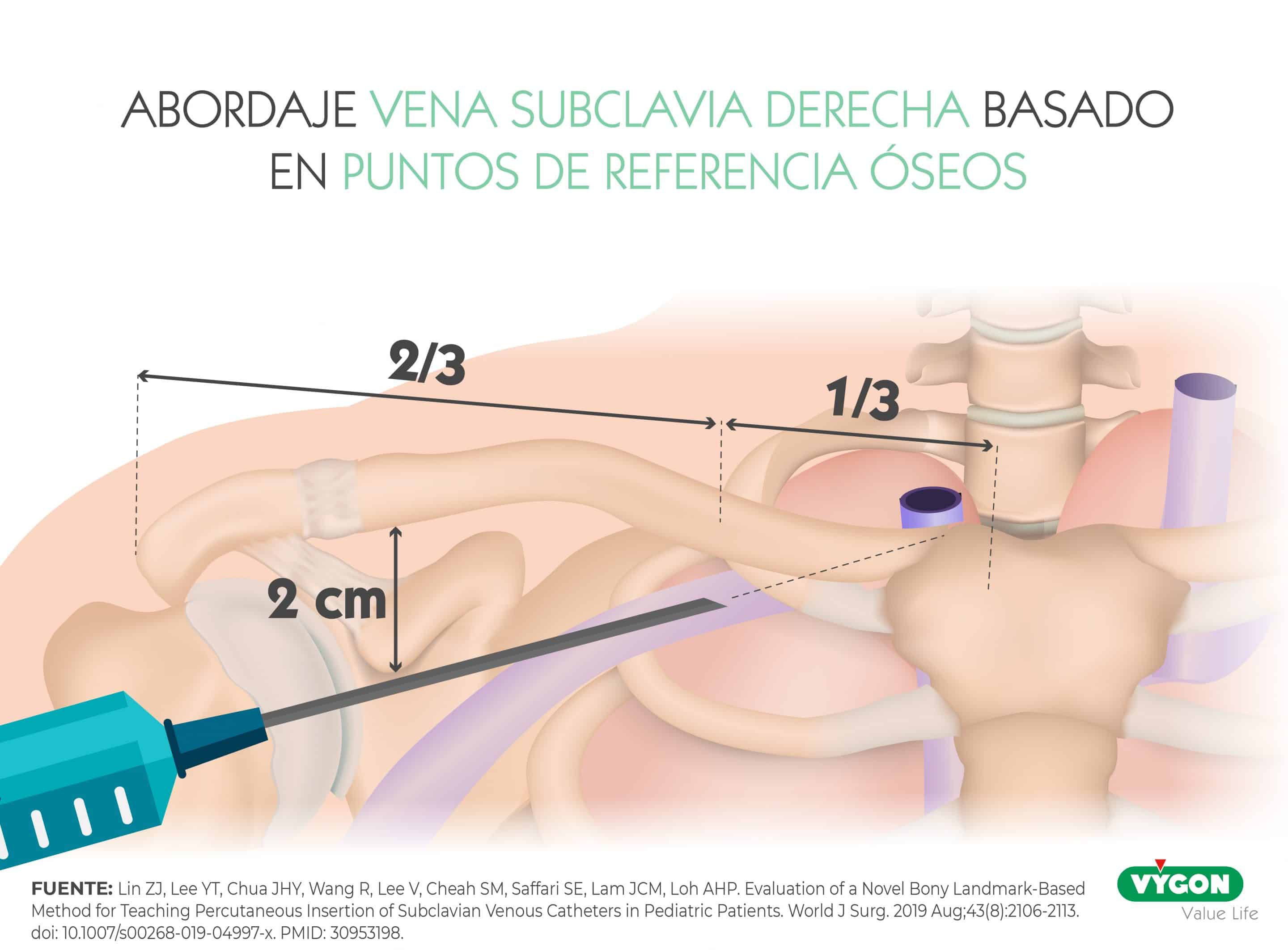 precisión vs exactitud