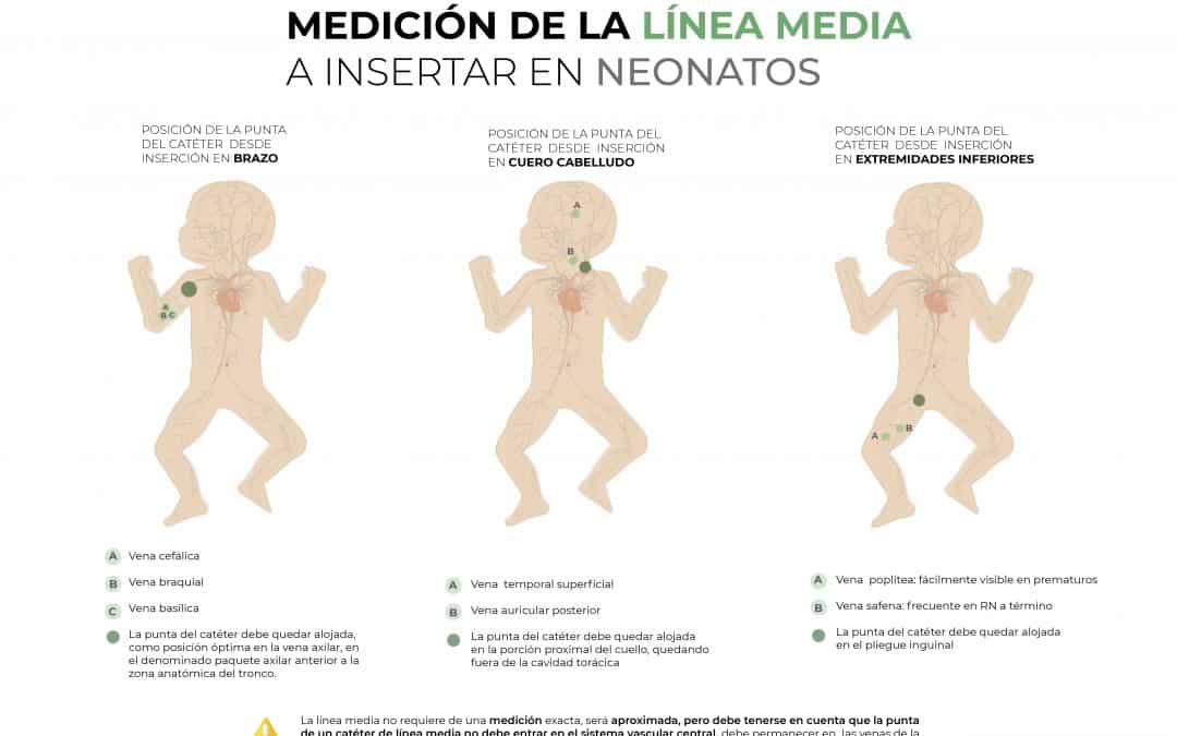 Medición de la Línea Media a insertar en Neonatos