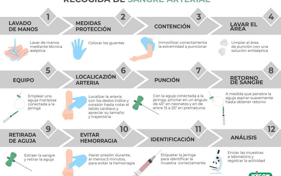 Recogida de sangre arterial en neonatos