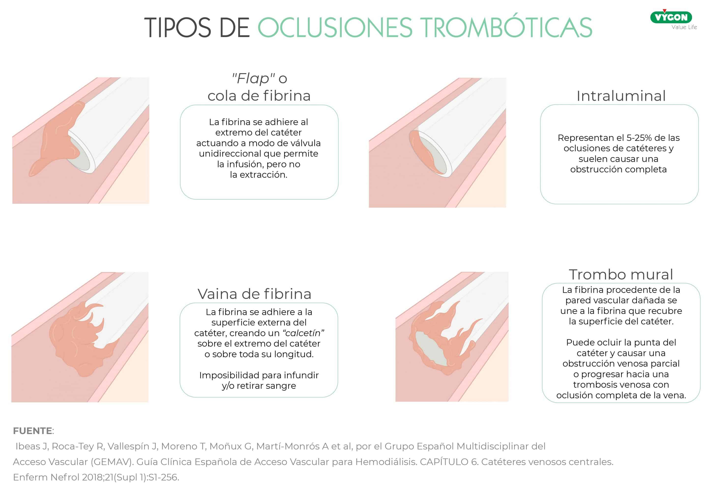 precisión vs exactitud