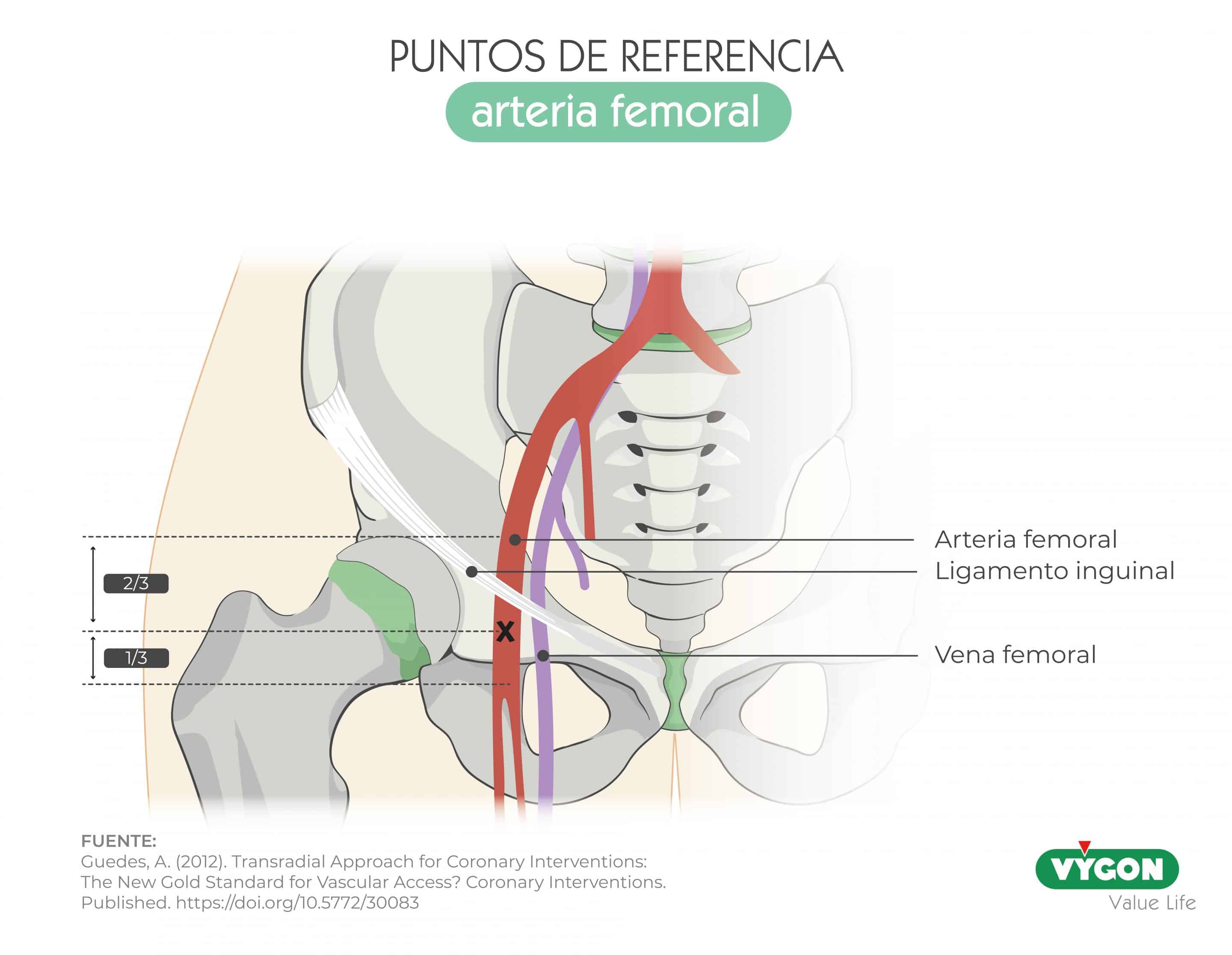 precisión vs exactitud