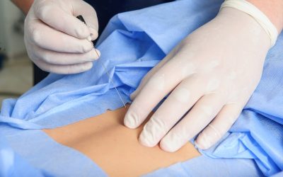 Hämodynamische Überwachung bei kardiogenem Schock 