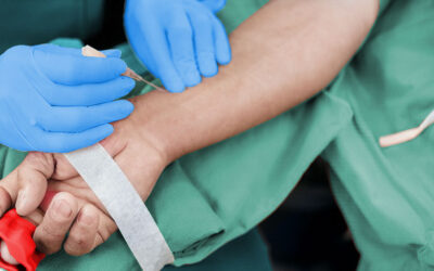 Die 9 Erfolgsfaktoren des arteriellen Gefäßzugangs