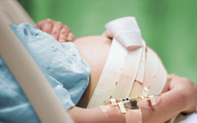 Die Rolle der Epiduralanästhesie bei der Geburt