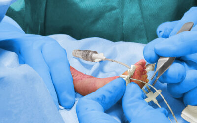 Die klinische Relevanz der modifizierten Seldinger-Technik (MST) in der Neonatologie