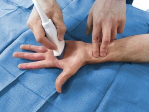 Die-Bedeutung-des-arteriellen-Zugangs-in-der-Intensivtherapie