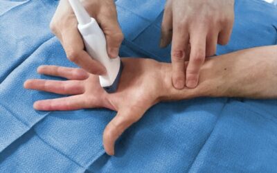 Die Bedeutung des arteriellen Zugangs in der Intensivtherapie