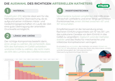 Die Auswahl des richtigen arteriellen Katheters