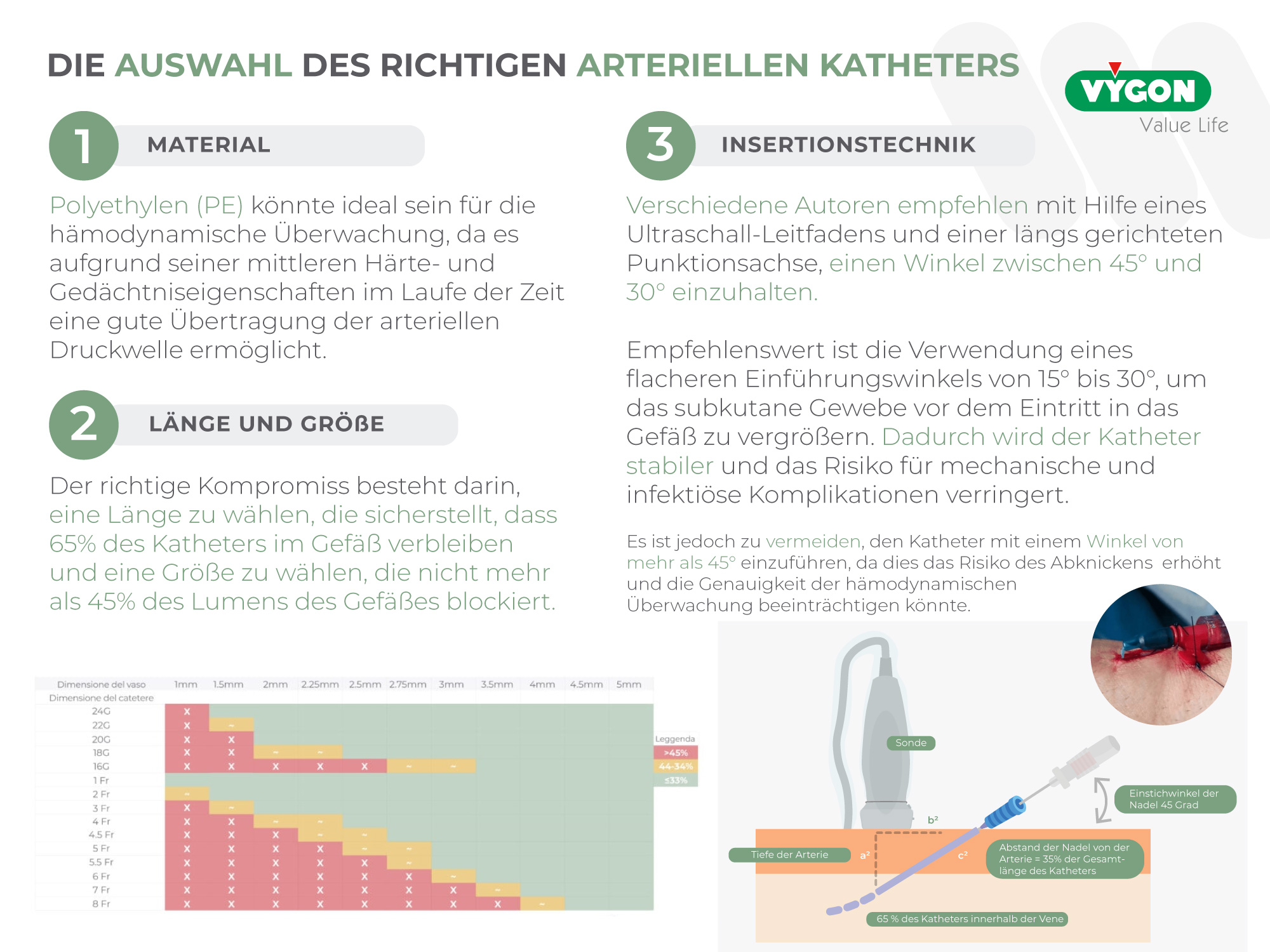 Die Auswahl des richtigen arteriellen Katheters