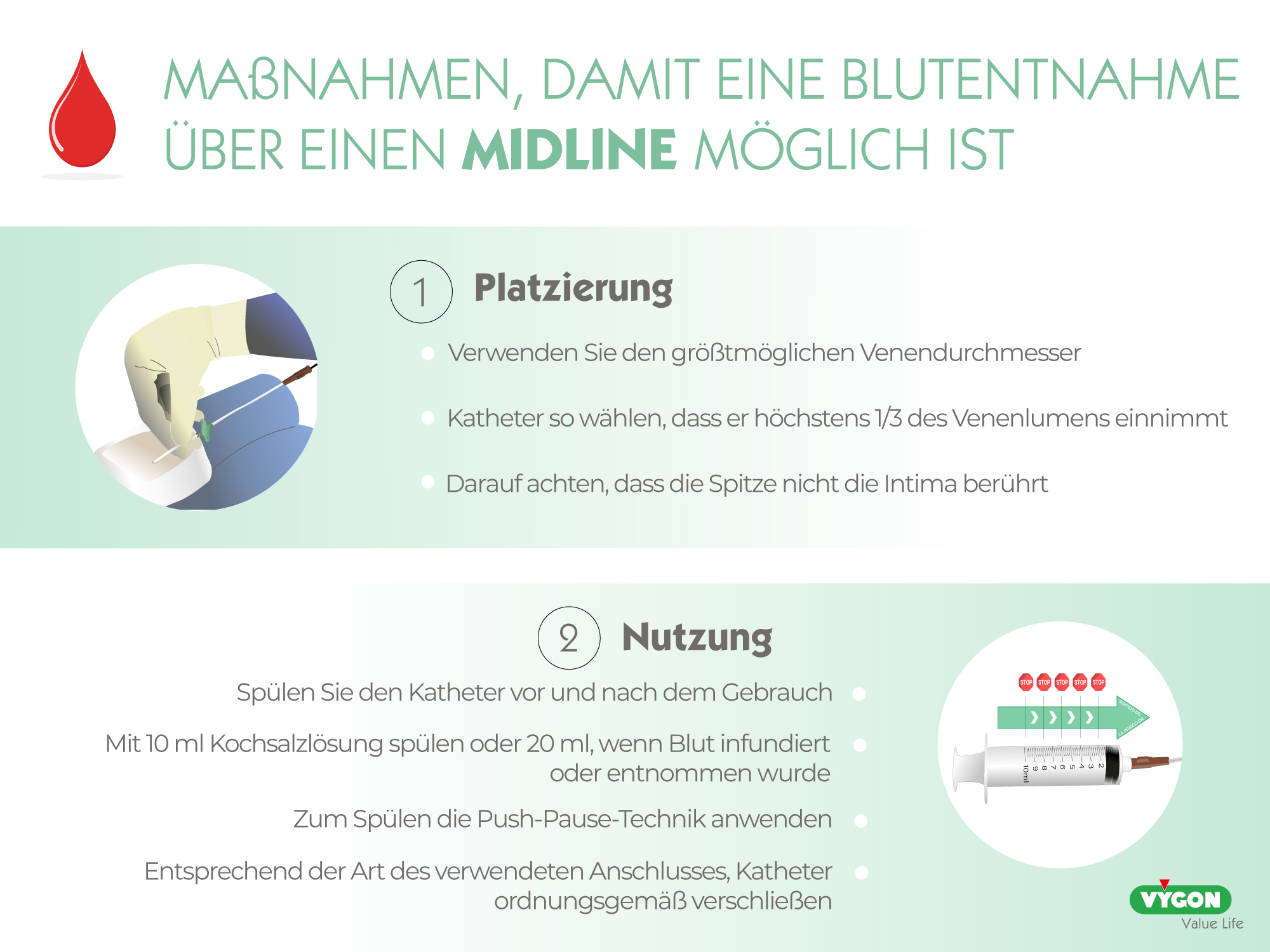 Maßnahmen, damit eine Blutentnahme über einen Midline-Katheter möglich ist