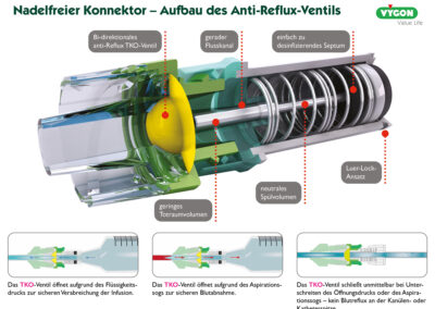 Nadelfreier Konnektor – Aufbau des Anti-Reflux-Ventils
