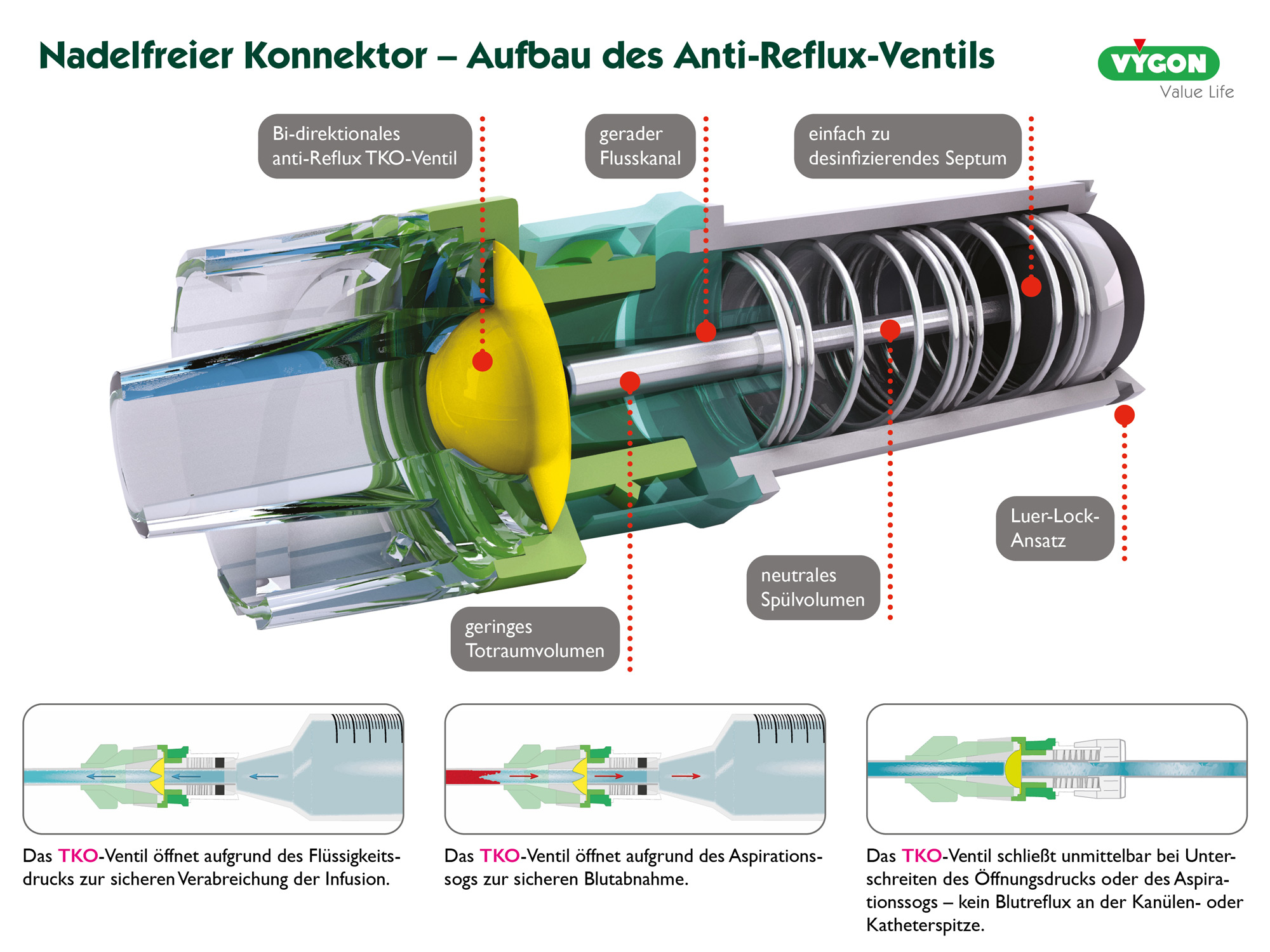 Nadelfreier Konnektor - Aufbau des Anti-Reflux-Ventils