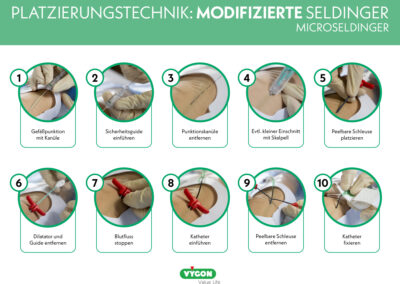 Platzierungstechnik – Modifizierte Seldinger-Technik – Microseldinger