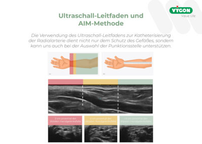 Ultraschall-Leitfaden und AIM-Methode