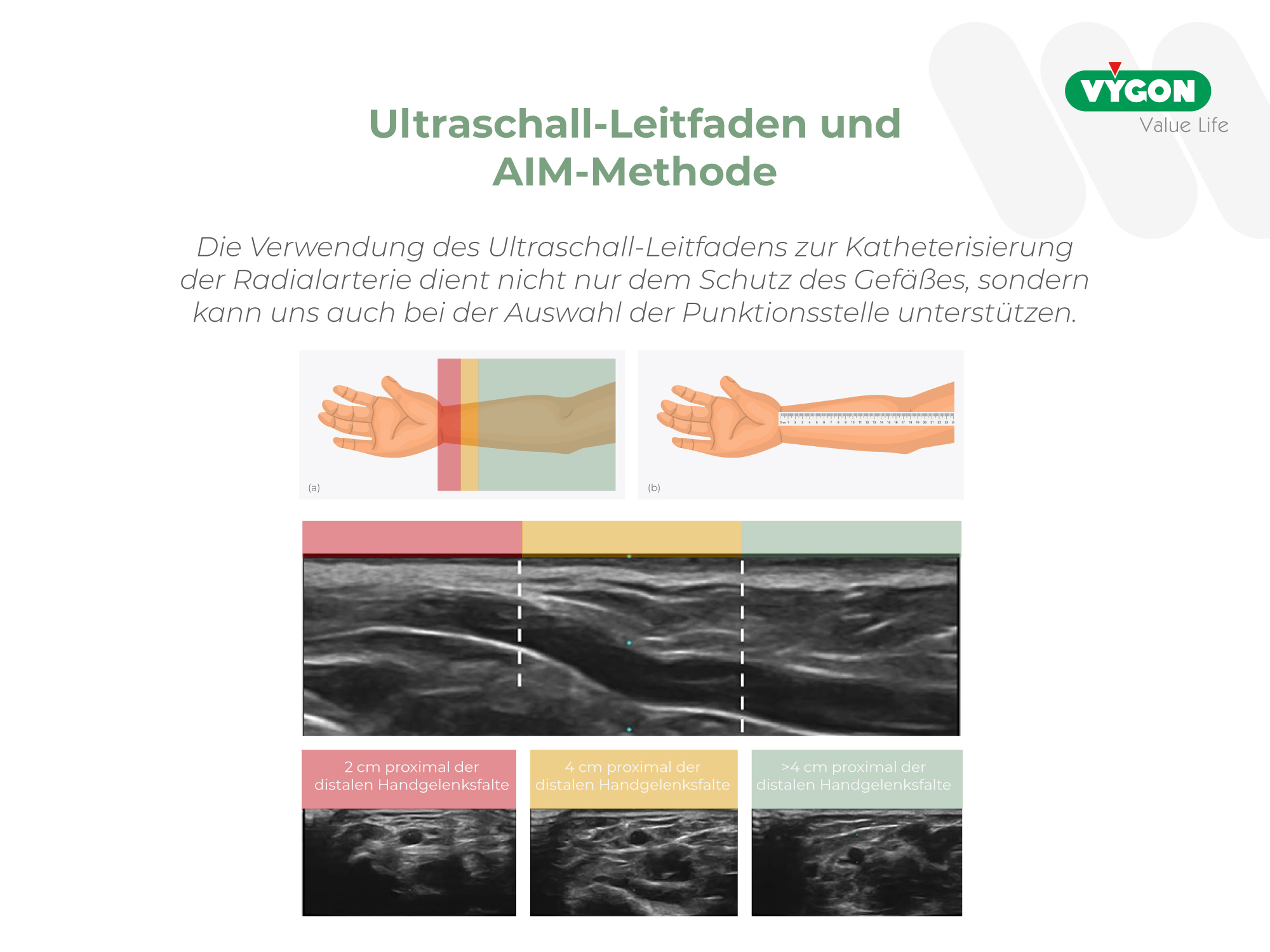 Ultraschall-Leitfaden und AIM-Methode