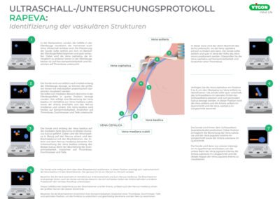 Ultraschall-Untersuchungsprotokoll – RaPeVA-Methode