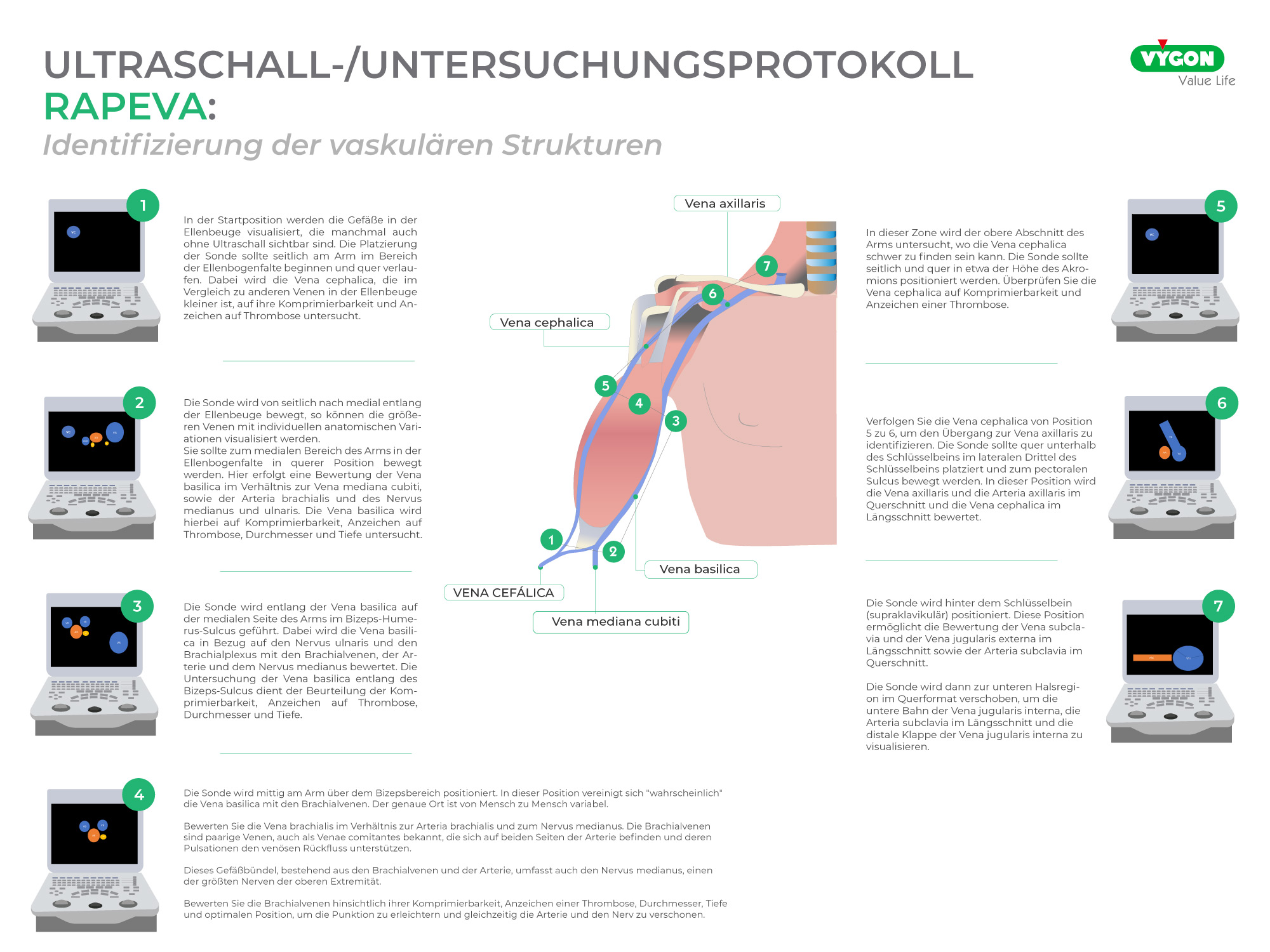 Ultraschall-Untersuchungsprotokoll - RaPeVA-Methode