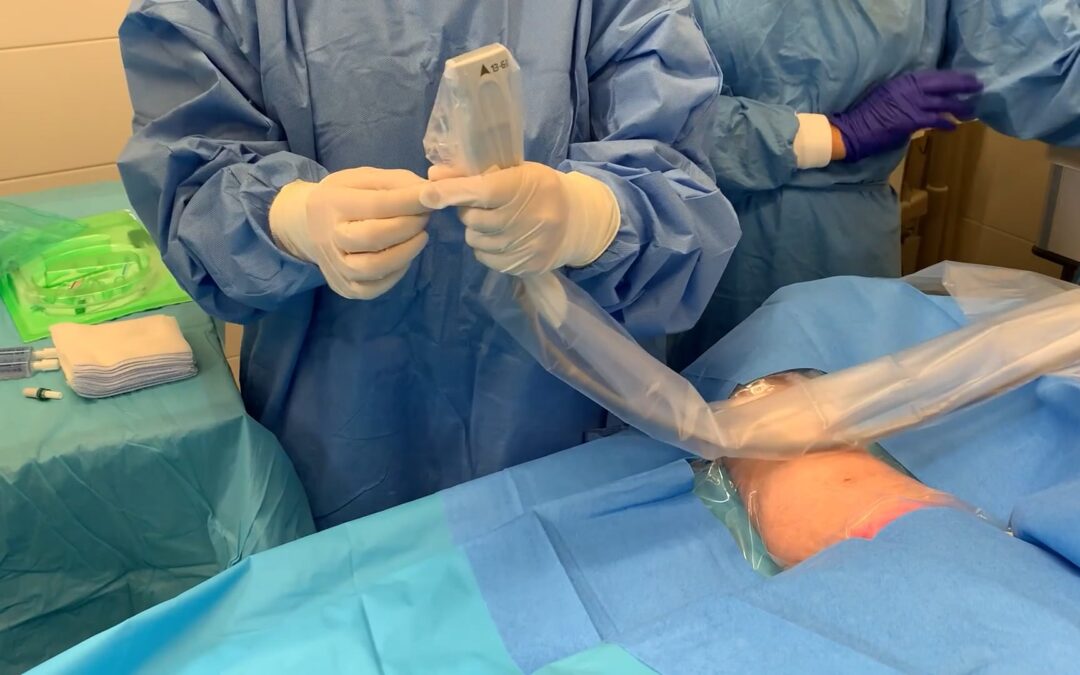 Anlage Mini-Midline-Katheter – Platzierung mittels Ultraschall