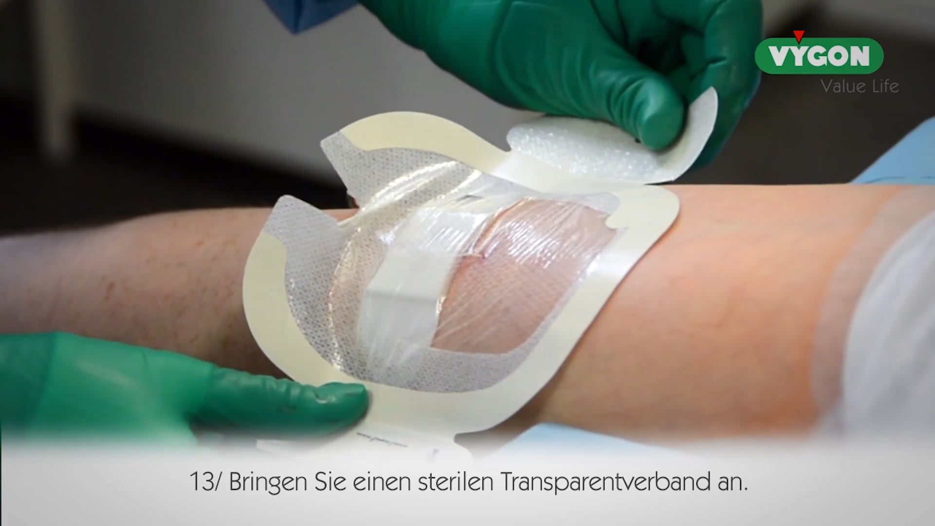 Anlage Mini-Midline-Katheter – Platzierung im Oberam