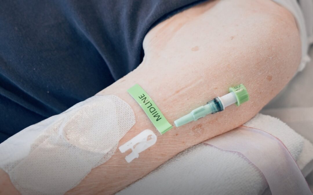 Anlage Midline-Katheter – Bettseitige Platzierung mittels Ultraschall