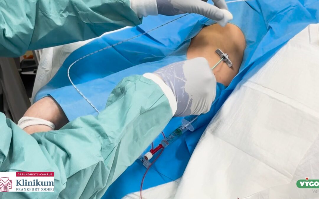 Anlage PICC-Katheter – Platzierung mittels EKG